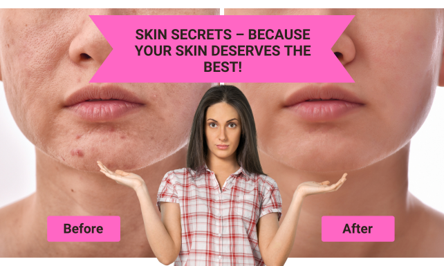 skin secrets